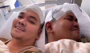 Indra Bekti Diizinkan Pulang dan Memakai Alat Bantu Seumur Hidup